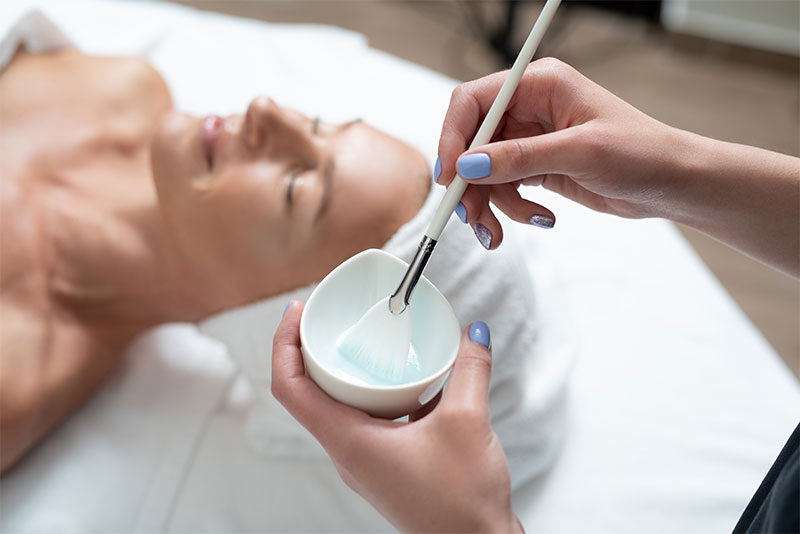 chemical-peel